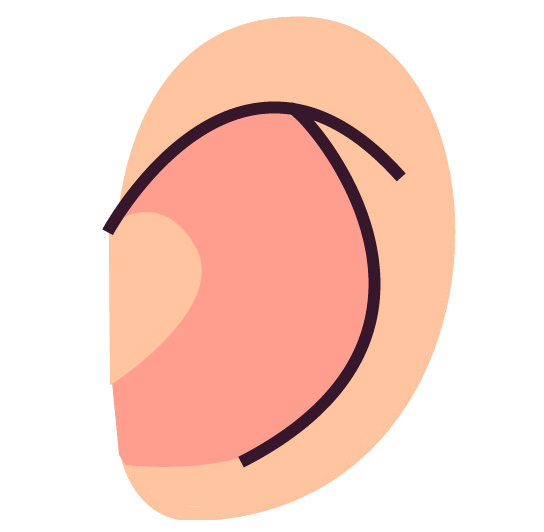 Montessori for Special Needs Children in Delhi